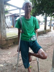 Hidup Kekurangan dan Kaki Cacat, Warga Banyuasin Ini Butuh Uluran Tangan